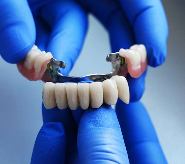 Metairie Dental Bridges